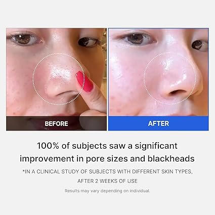 MEDICUBE Zero Pore Pad (V1)
