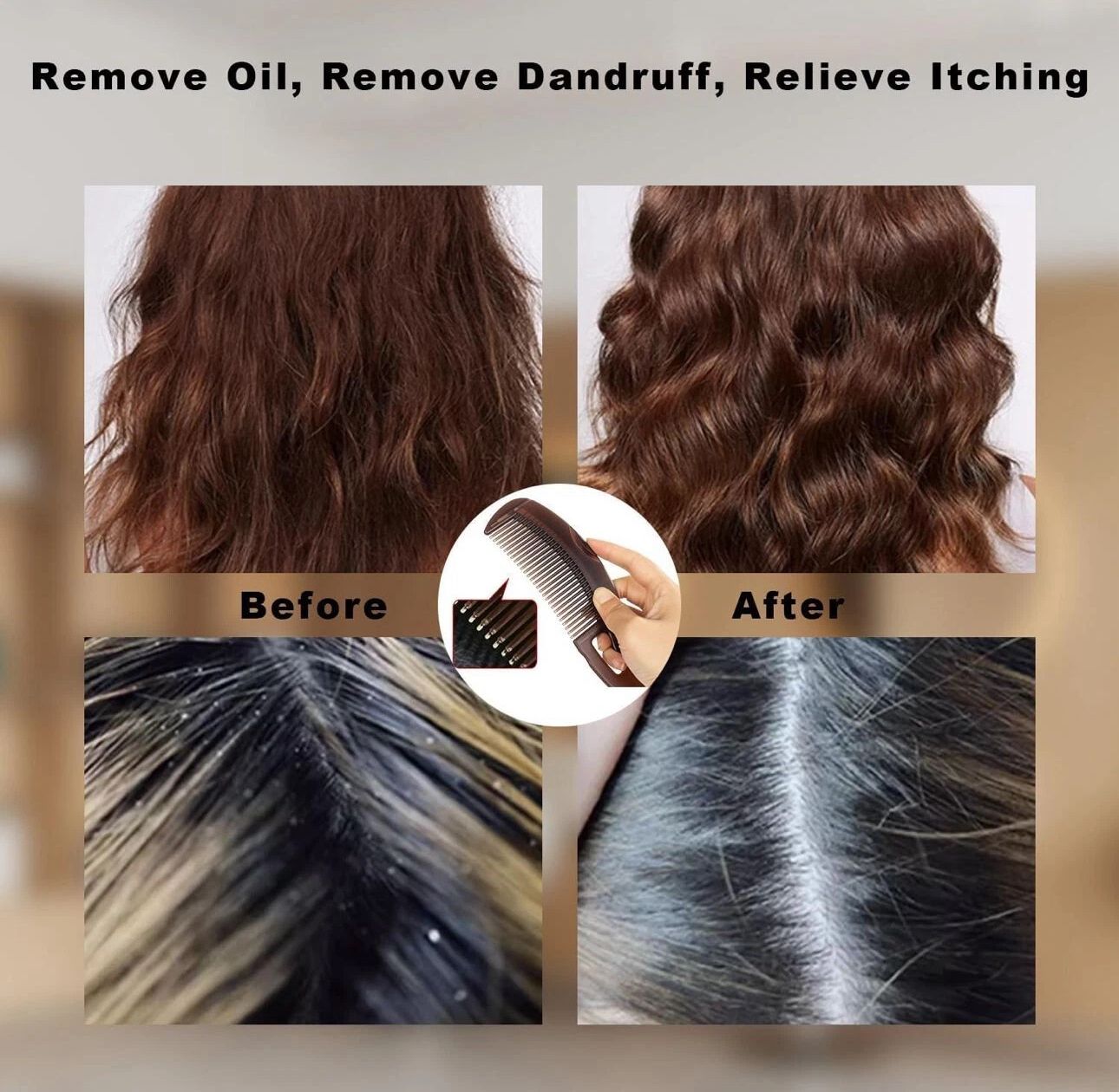 Detox Scalp Comb – Hollow Tooth Anti-Dandruff Energy Massager