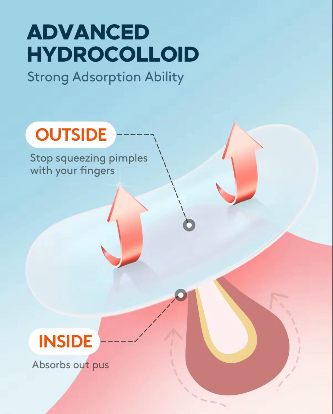 30 Invisible Acne Patches + Essential Oil – Clear Skin Care Set